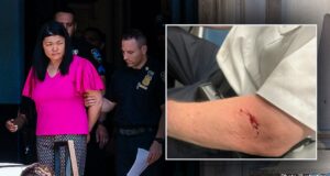 Democratic council member who allegedly chomped on police officer’s arm blames ‘police brutality’