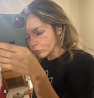 Tamara commenting on her feeling of having a lucky escape