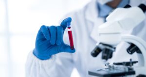 Colon cancer blood screening test approved by FDA: ‘Early detection is critical’