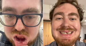 Journalist brutally assaulted while covering Southport protests in England, police initially refused to help