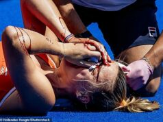 Olympic Games semi final brought to a halt after female star suffered sickening injury: ‘So much blood’