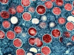 WHO asks experts if Mpox outbreak in Africa is global emergency